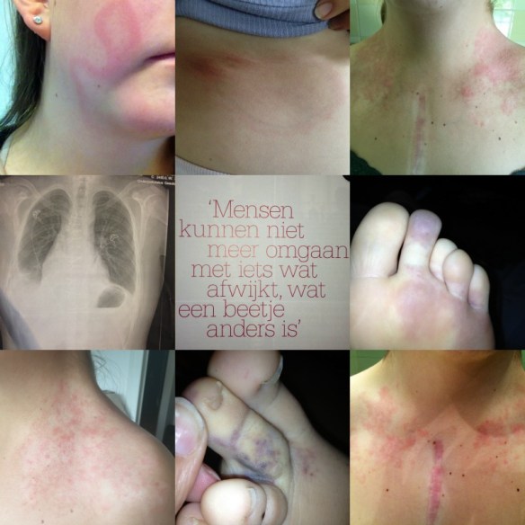 Hartekinderen|Mensen kunnen niet meer omgaan met iets wat afwijkt of anders is.